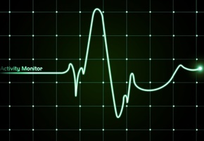 график, зелёный, Линия